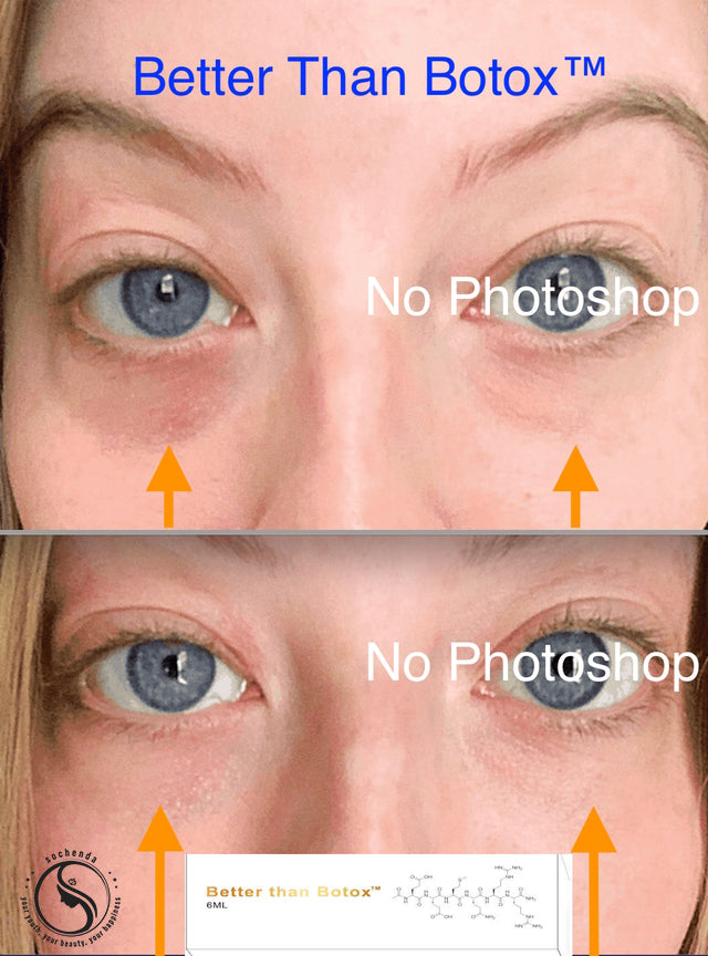 Quantum Facial "Professional Edition" – Better Than Botox™ Reduce Wrinkles | Firm Skin | Revitalize Under Eyes