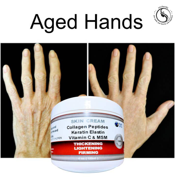 Saggy Arms &amp; Wrinkled Neck Firming Skin Cream Tighten | Hydrate | Restore Elasticity