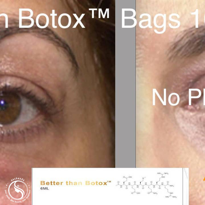 Quantum Facial "Professional Edition" – Better Than Botox™ Reduce Wrinkles | Firm Skin | Revitalize Under Eyes