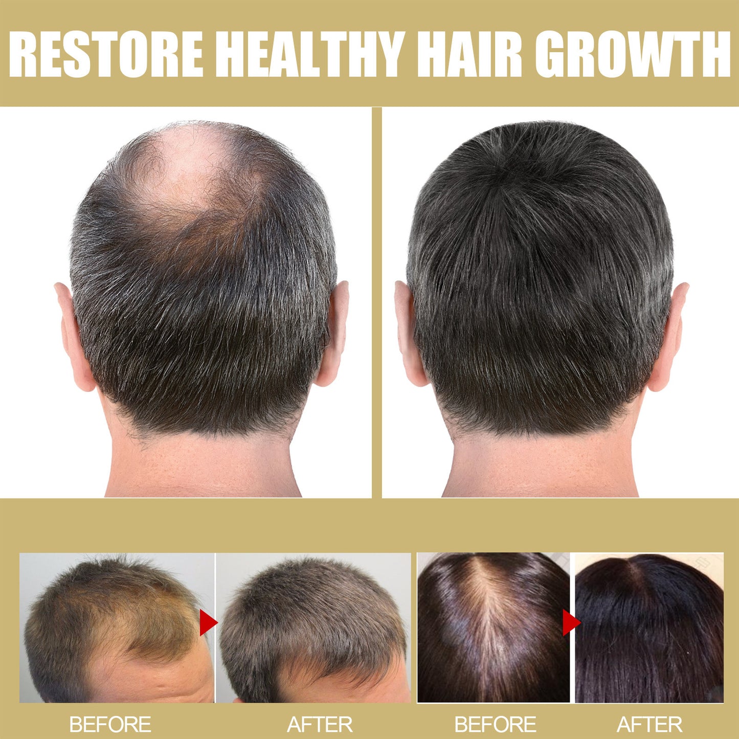 Houkea Dense Toupee Hair Repair Manic Thick Hairline Fixation Head Massage Care Heating Cap