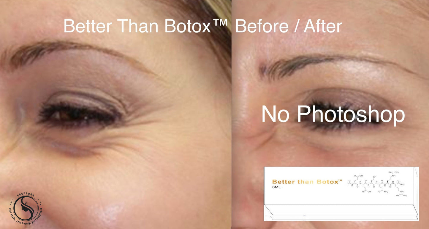 Quantum Facial "Professional Edition" – Better Than Botox™ Reduce Wrinkles | Firm Skin | Revitalize Under Eyes