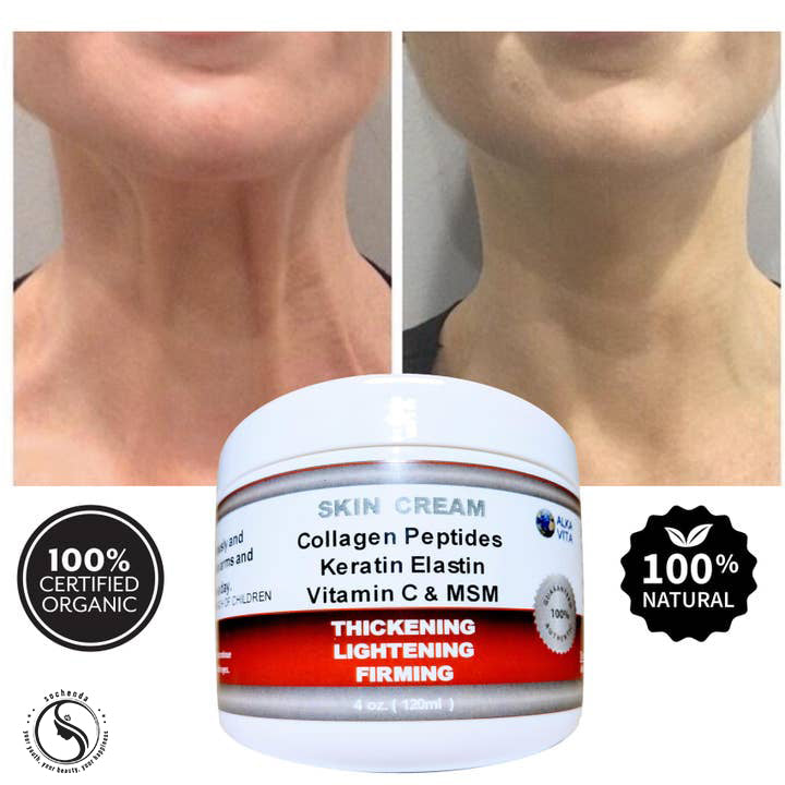 Saggy Arms &amp; Wrinkled Neck Firming Skin Cream Tighten | Hydrate | Restore Elasticity