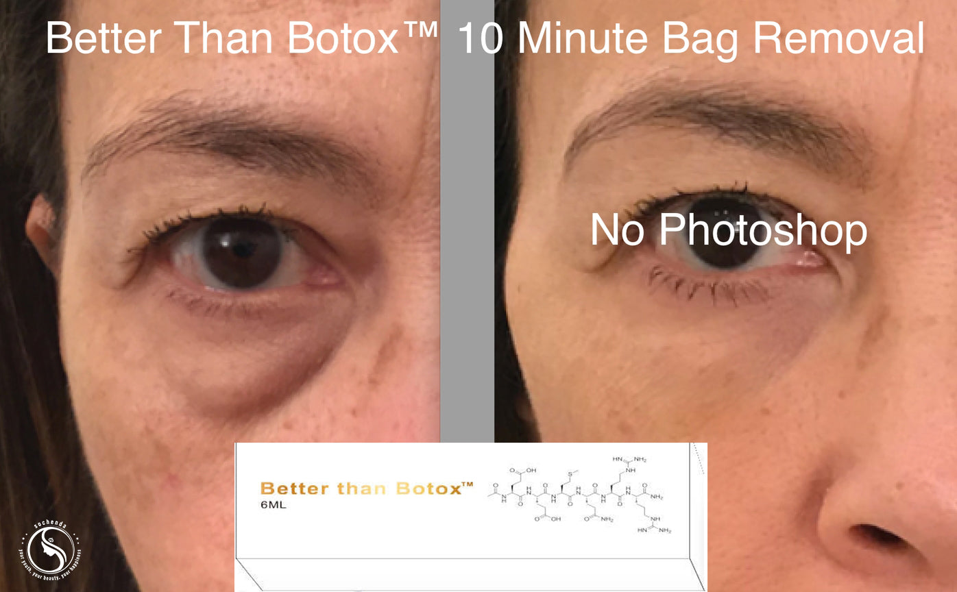 Quantum Facial "Professional Edition" – Better Than Botox™ Reduce Wrinkles | Firm Skin | Revitalize Under Eyes