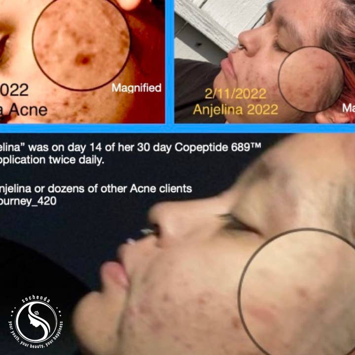 Copeptide 689 – Advanced Skin Repair System Reverse Aging | Reduce Scars | Restore Radiance