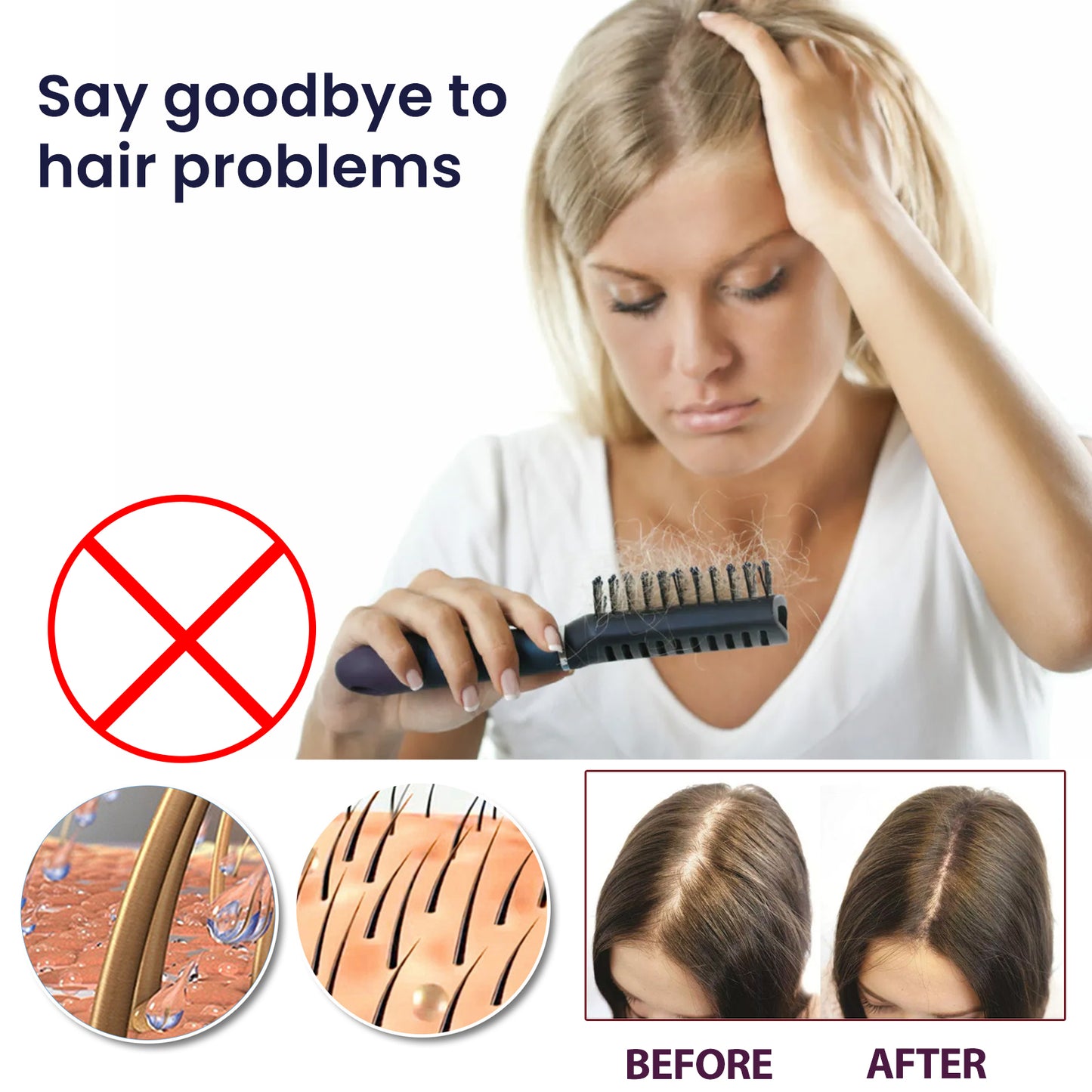 OUHOE Hair Treatment Spray Strengthens Hair, Moisturizes Hair, Improves Dry And Irritated Hair And Hydrates Hair Treatment Spray