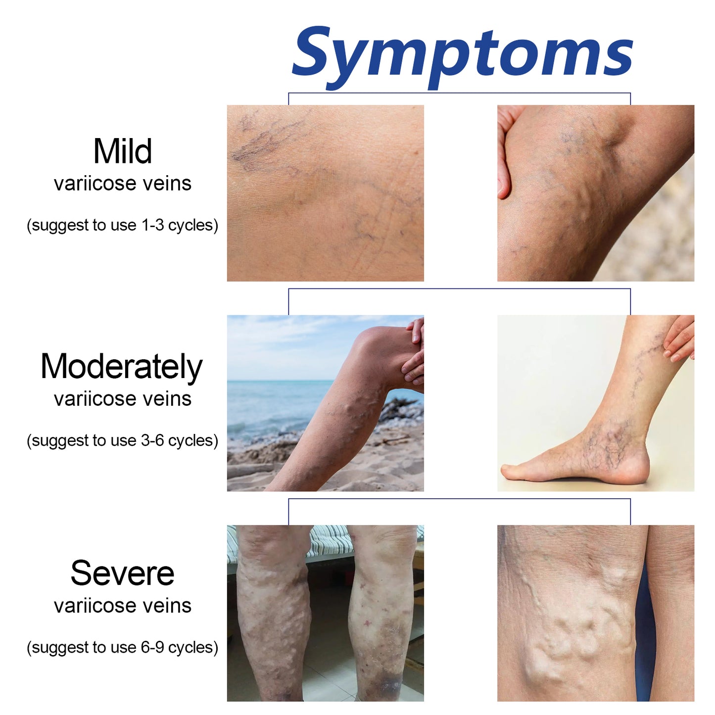 HouKea Heating Leg Cover, Relieve Lymphatic Swelling Venous Care Smooth Blood Vessel Bulges Warm Warm Leg Cover