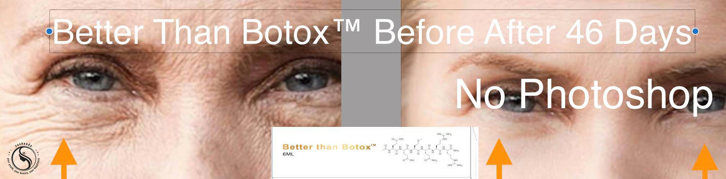 Quantum Facial "Professional Edition" – Better Than Botox™ Reduce Wrinkles | Firm Skin | Revitalize Under Eyes